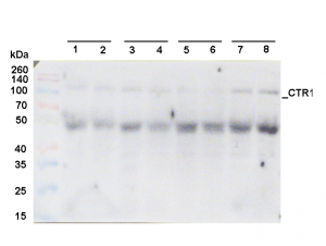 CTR1 | Constitutive triple response 1 in the group Antibodies Plant/Algal  / Hormones / Biosynthesis/regulation at Agrisera AB (Antibodies for research) (AS16 3988)